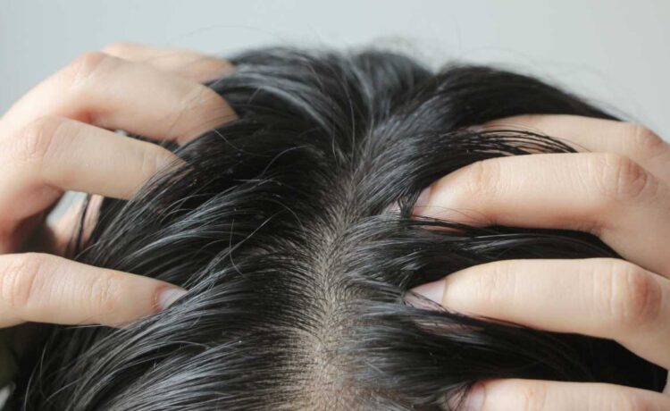 Descubra os melhores cuidados diários para combater a oleosidade excessiva do cabelo 1 abelo frizz 2
